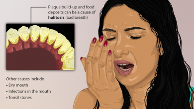Photo of Natural Cure For Mouth Odor Home Made Remedy That Will Help You
