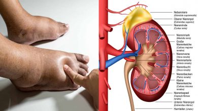 Photo of 6  THINGS  YOU DO THAT CAUSES KIDNEY DISEASE YOU DON’T KNOW