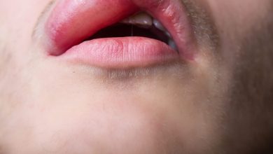 Photo of SIMPLE CURE TO SWOLLEN LIPS