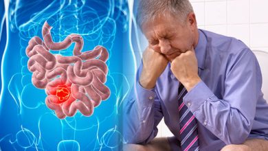 Photo of HARD STOOL/BLOODY STOOL HOME REMEDY THAT WORKS IN 3 DAYS