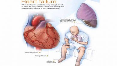 Photo of SYMPTOMS AND CAUSES OF HEART FAILURE  YOU DON’T KNOW