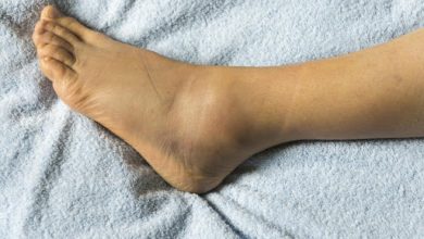 Photo of 5 NATURAL REMEDIES FOR SWOLLEN FEET AND ANKLES