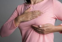 Photo of SYMPTOMS AND CAUSES OF BREAST CANCER