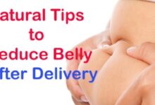 Photo of REMEDY FOR FLAT TUMMY AFTER CESAREAN DELIVERY(C-SECTION)