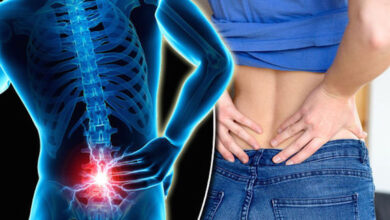Photo of 6 HOME REMEDY FOR BACK PAIN