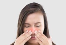 Photo of NATURAL HOME REMEDIES FOR POST-NASAL DRIP