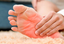 Photo of HOME REMEDIES FOR BURNING FEET