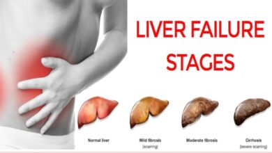 Photo of 6 BEST HOME REMEDY FOR LIVER FAILURE