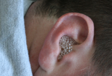 Photo of EFFECTIVE HOME REMEDY FOR EAR INFECTION THAT WORKS IN DAYS