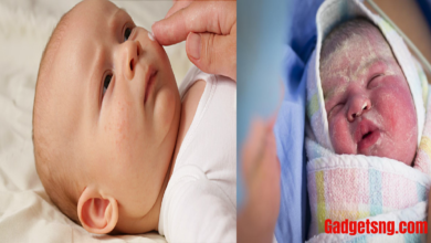 Photo of HOME REMEDY FOR NEWBORN’S DRY AND PEELING SKIN