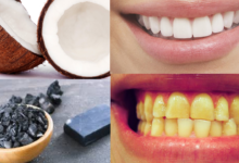 Photo of 7 WAYS TO GET WHITE TEETH IN 7 DAYS