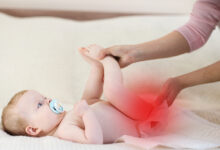 Photo of SUPER EFFECTIVE HOME REMEDY FOR DIAPER RASH THAT WORKS IN 2DAYS