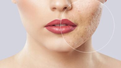Photo of CLEAR SKIN BLEMISHES OVERNIGHT