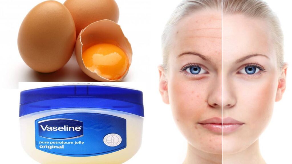 VASELINE AND EGG YOLK REMEDY TO LOOK 10 TIMES YOUNGER Health GadgetsNG