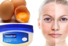 Photo of VASELINE AND EGG YOLK REMEDY TO LOOK 10 TIMES YOUNGER