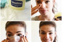 Photo of Natural Ways to Get Rid of Blackheads and Whiteheads Fast