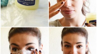 Photo of Natural Ways to Get Rid of Blackheads and Whiteheads Fast