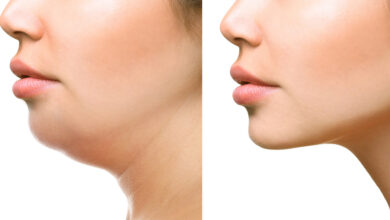 Photo of GET RID OF NECK FAT OVERNIGHT WITH THIS REMEDY