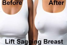 Photo of FIRM SAGGING BREAST WITH THIS SIMPLE SOLUTION