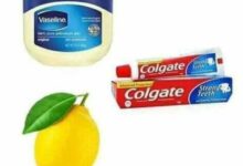 Photo of WAYS TO USE TOOTHPASTE TO ACHIEVE A PERFECT SKIN