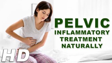Photo of NATURAL  REMEDIES FOR PELVIC INFLAMMATORY DISEASE(PID)