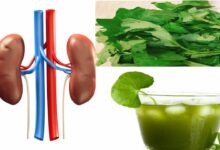 Photo of CLEAN  KIDNEY WITH THIS REMEDY TO AVOID KIDNEY FAILURE