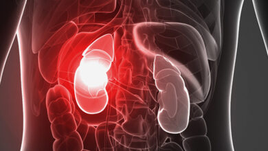 Photo of CENT LEAF: BEST HERBAL SOLUTION FOR KIDNEY CLEASING