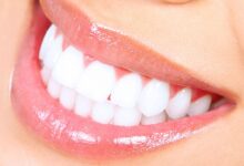 Photo of CAUSES AND PREVENTIONS OF YELLOW TEETH