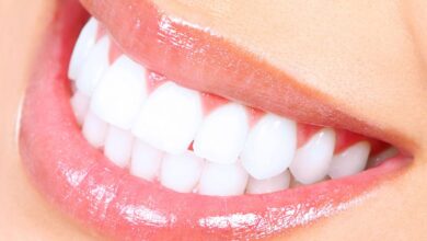 Photo of CAUSES AND PREVENTIONS OF YELLOW TEETH