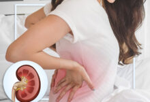 Photo of CAUSES OF CHRONIC KIDNEY DISEASE AND PREVENTIONS