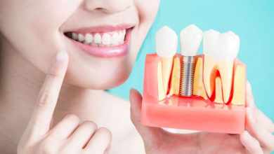 Photo of Top 5 Benefits Of Getting Dental Implants