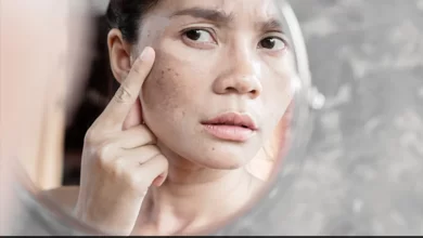 Photo of The Easiest Way to Get Rid Of Dark Spots And Uneven Skin Tones
