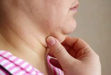 Photo of 10 Ways To Get Rid Of A Double Chin, Exercises, & Prevention