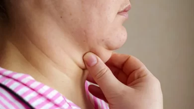 Photo of 10 Ways To Get Rid Of A Double Chin, Exercises, & Prevention