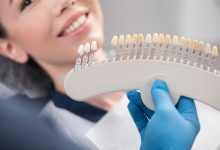 Photo of The Amazing Benefits of Getting Dental Veneers