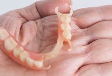 Photo of Can Repairs be Carried out on Removable Partial Dentures