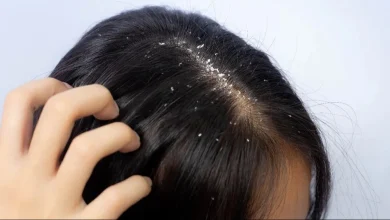 Photo of The Science Behind Anti-Dandruff Shampoos — What Every Indian Should Know Before Buying